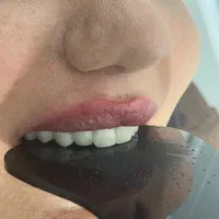 دندان سازی|خدمات آرایشگری و زیبایی|خوی, |دیوار