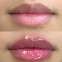 خدمات زیبایی و ژل و بوتاکس