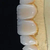 کاراموز لابراتوار دندانسازی
