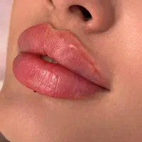 جشنواره ۵۰٪ تخفیفات ژل بوتاکس فیلر مزو دکتر اقساطی