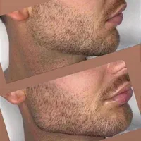 بوتاکس ژل ساکشن چربی جراحی بینی در کلینیک بهنود|خدمات آرایشگری و زیبایی|تبریز, |دیوار