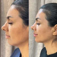 خدمات و آموزش تخصصی پوست و زیبایی|خدمات آرایشگری و زیبایی|شیراز, ارم|دیوار