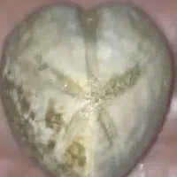 سنگ|جواهرات|خرمشهر, |دیوار