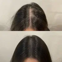 واقعا چرا کاشت وقتی من هستم