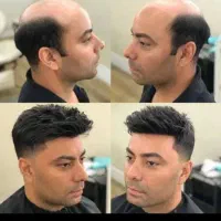 پروتز تخصصی مو ، فر شش ماه|خدمات آرایشگری و زیبایی|قم, بنیاد|دیوار