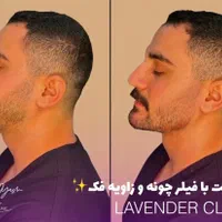 جشنوار تابستانه ژل و بوتاکس و شرایط اقساطی|خدمات آرایشگری و زیبایی|آمل, |دیوار