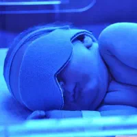 اجاره بروز ترین دستگاه های درمان زردی نوزادان