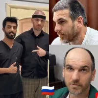 کاشت مو شیرازی در کرمان