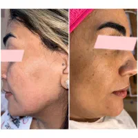 پاکسازی و فیشال تخصصی(بانوان)|خدمات آرایشگری و زیبایی|شاهین‌شهر, حافظ شمالی|دیوار