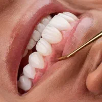 دندانپزشکی باشرایط اقساط