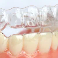 دندانپزشکی. ارتودنسی نامرئی( شفاف)