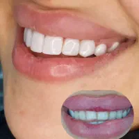 کارت تخفیف دندانپزشکی/ارتودنسی/کامپوزیت با نیم بها|کارت هدیه و تخفیف|گرگان, |دیوار