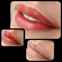 شیدینگ لب و رفع انواع کبودی
