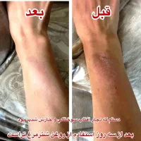 روغن شترمرغ تراست|آرایشی، بهداشتی، درمانی|بندرعباس, |دیوار