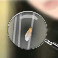 محلول ضد شپش از بین برنده تخم شپش (رشک) پنج دقیقه|آرایشی، بهداشتی، درمانی|بم, |دیوار