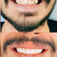 تخفیف ویژه خدمات دندان پزشکی/مشاوره رایگان/اقساطی