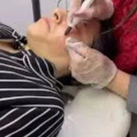 حذف و درمان  کک ومک در یک جلسه