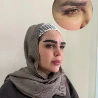 جشنواره تخفیف میکروکاشت ابرو با و بدون جراحی|خدمات آرایشگری و زیبایی|شیراز, قدوسی غربی|دیوار