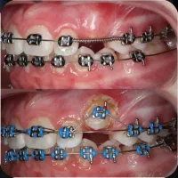 دندانپزشکی،ارتودنسی اقساطی، پایینتر از تعرفه دولتی