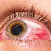 درمان دیابت(تضمینی)تخصصی)+|خدمات آرایشگری و زیبایی|خرمشهر, |دیوار