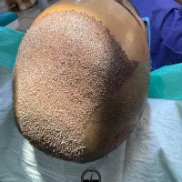 کاشت تخصصی مو و ابرو و ریش و سبیل|خدمات آرایشگری و زیبایی|شیراز, رحمت‌آباد|دیوار