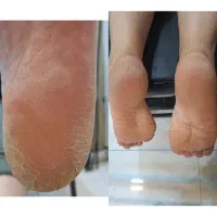 پدیکور. پا|خدمات آرایشگری و زیبایی|یاسوج, |دیوار