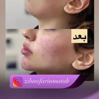 کلینیک زیبای و جراحی|خدمات آرایشگری و زیبایی|بندر گناوه, |دیوار