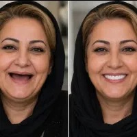 دندانسازی تجربی نوین