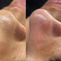 خدمات فشیال تخصصی خانوم وآقا|خدمات آرایشگری و زیبایی|سنندج, |دیوار