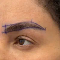کاشت ابرو به روش میکروکاشت با نیدل بنفش