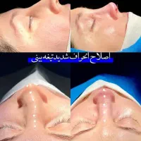 زیبایی خودتون رو به ما بسپارین اهواز|خدمات آرایشگری و زیبایی|شوشتر, |دیوار