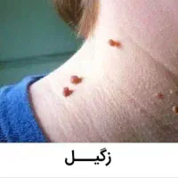 برداشت خال زگیل میخچه ختنه در مطب|خدمات آرایشگری و زیبایی|قم, هفت تیر|دیوار