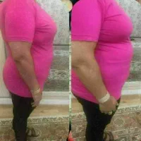 لاغری تضمینی وتخصصی بابروزترین دستگاه ۲۰۲۵