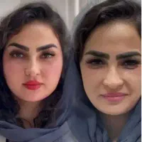 جشنوارفقط تافردا)هایفوگلد فقط1/950با20خدمات رایگان