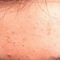 راهنمایی برای طبع بدن
