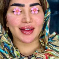 ژل صورت و لب اف ویژه فقط سیسی ۷۹۹
