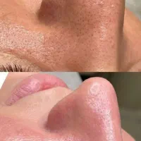 فیشیال|خدمات آرایشگری و زیبایی|شیراز, گلشن|دیوار