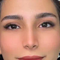 کاشت مژه هیدن