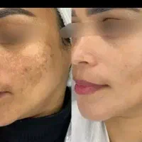 از مرگ خاموش نجاتت میدم
