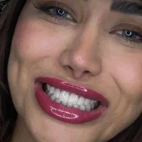 دندانپزشکی/کامپوزیت/عصبکشی دندان/ترمیم/ایمپلنت