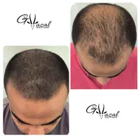 میکرواسکالپ سر، میکروبلیدینگ ابرو، شیدینگ لب|خدمات آرایشگری و زیبایی|شاهین‌شهر, فردوسی|دیوار