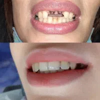 مرکز تخصصی ایمپلنت دیجیتال شرق تهران