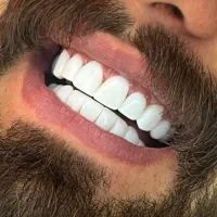 بلیچینگ، درمان و زیبایی بیمه تکمیلی(وآزاداقساطی)|خدمات آرایشگری و زیبایی|بافت, |دیوار