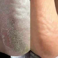 بافتمو..کاشت و ترمیم ناخن.اسپا و پدیکور بعثت