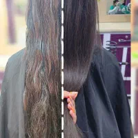 پکیج موخوره گیری *شگفتانه*