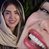 ایمپلنت اقساطی دندانپزشکی لمینیت|خدمات آرایشگری و زیبایی|کیش, |دیوار