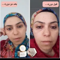 کرم رویال ۸۰۰|آرایشی، بهداشتی، درمانی|بهبهان, |دیوار