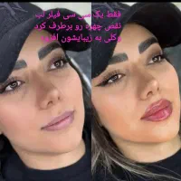 ژل،فیلربادی،بیکینی،بوتاکسprp لیفت صورت|خدمات زیبایی و سلامت|تبریز, |دیوار