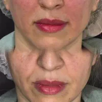 خدمات تخصصی پوست و مو در کلینیک فرسیما|خدمات آرایشگری و زیبایی|اسلام‌شهر, باغ فیض|دیوار