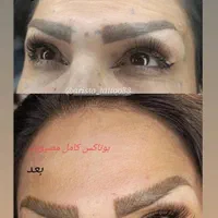 آموزش فیلر چونه بوتاکس ژل لب مزوژل پرسینگ|خدمات آرایشگری و زیبایی|مشهد, موسوی قوچانی|دیوار